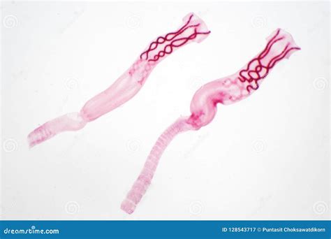  Alaria! A Parasitic Flatworm Thriving In the Guts of its Mammalian Hosts