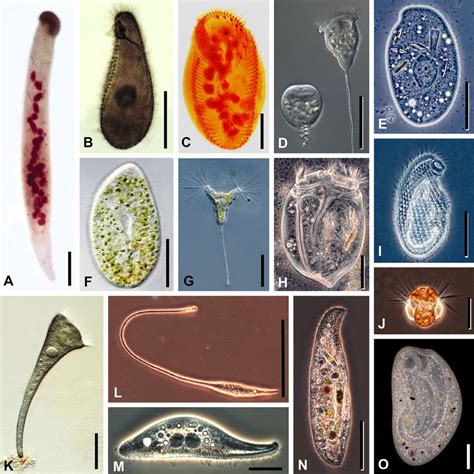  Rhinotrichum!  A Ciliate With Delicate Tentacles That Swims Through Water Like A Tiny Ballerina